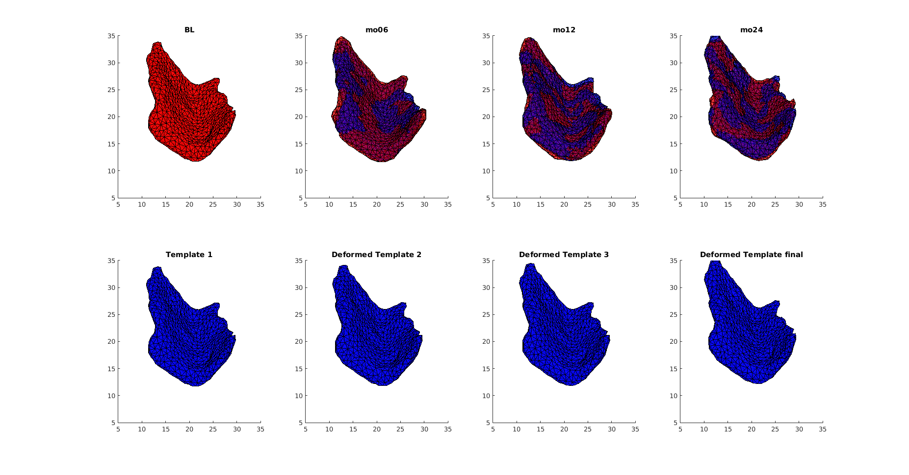 Characterizing the evolution of entorhinal cortex in AD patients